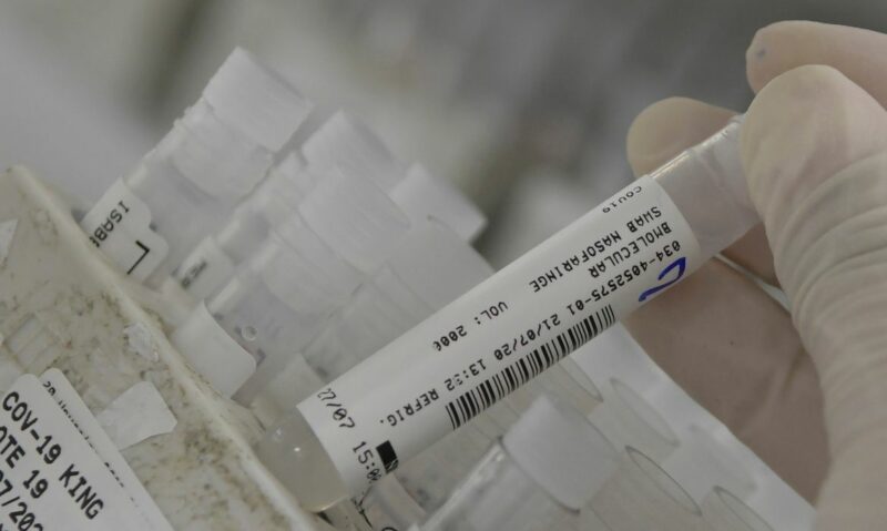 2020-07-24t143211z_1391278467_rc2qzh93g22g_rtrmadp_3_health-coronavirus-brazil-e1629046777159