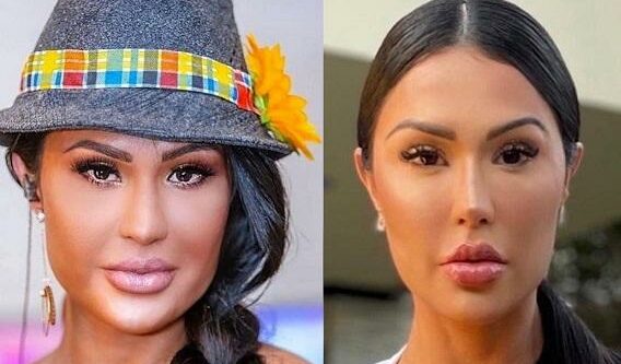 gracyanne-barbosa-afinamento-rosto