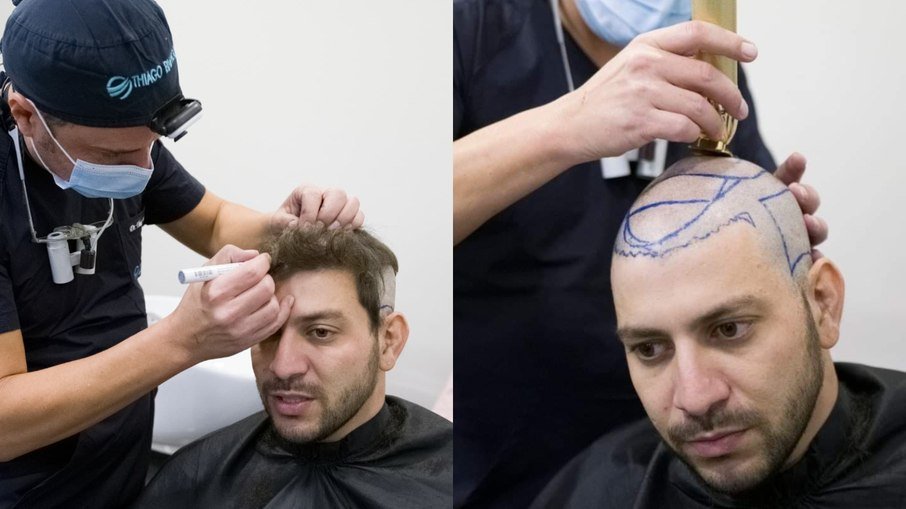 33fwdw1c9eql5j982z8dh9ogr