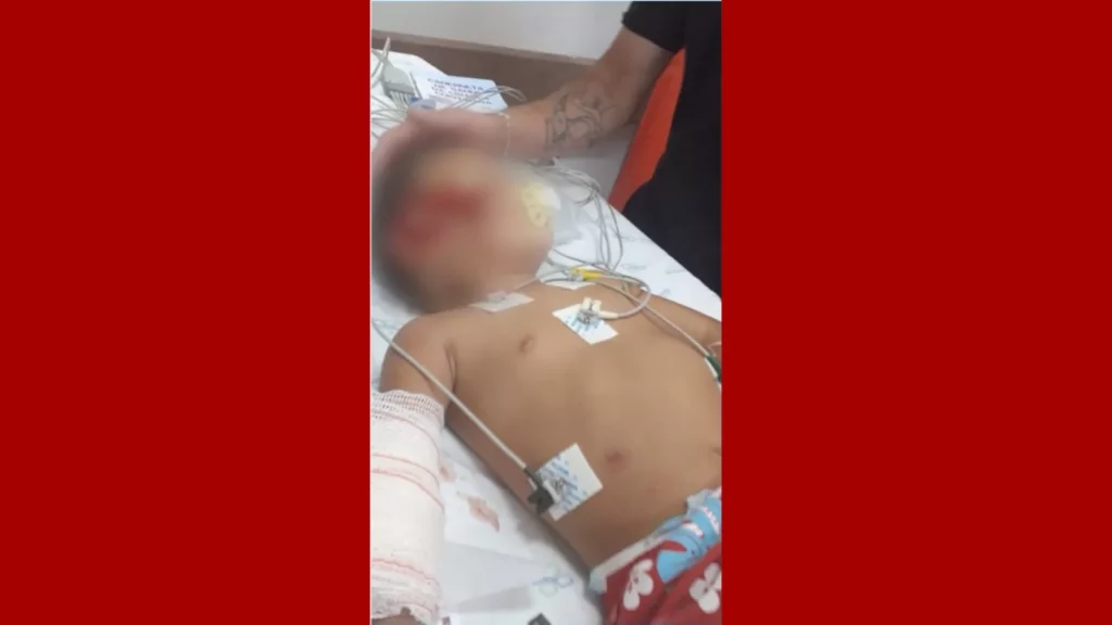 ATROPELA-CRIANÇA-VAN