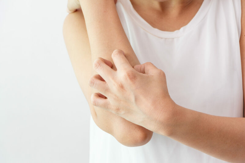 Women scratch the itch with hand / arm  itching / Concept with H