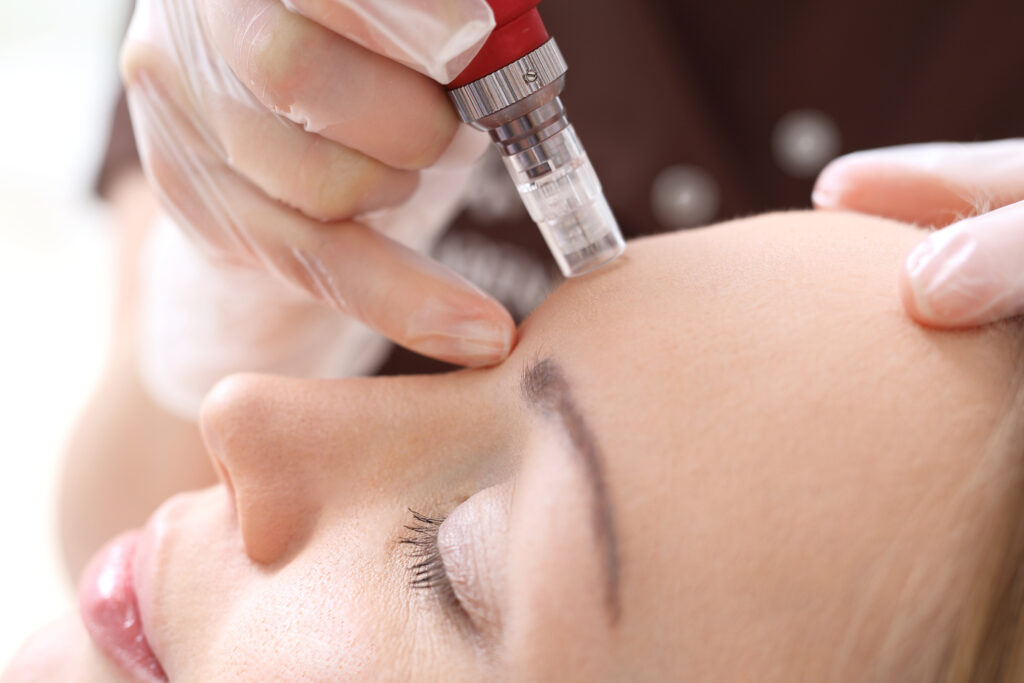 Needle mesotherapy treatment aesthetic execution in the beauty salon Needle mesotherapy treatment aesthetic execution in the beauty salon