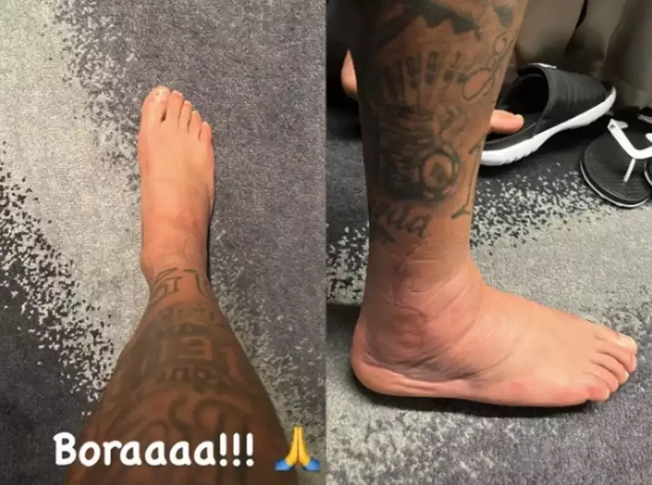 Tornozelo-Neymar__Reproducao