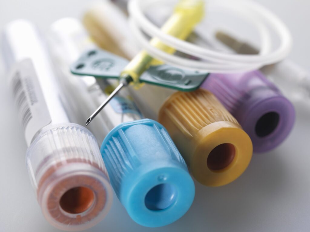 a-variety-of-medical-samples-including-blood-and-c-2022-03-04-01-50-06-utc-scaled a-variety-of-medical-samples-including-blood-and-c-2022-03-04-01-50-06-utc-scaled