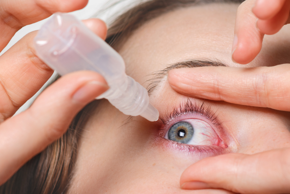 close-up-female-pours-drops-in-red-eye-has-conjuctivitis-or-glaucoma-bad-eyesight-and-pain-eyes-pain-treatment-concept-woman-cures-red-blood-eye