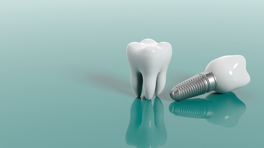 Teeth isolated on green background. 3d illustration Teeth isolated on green background. 3d illustration