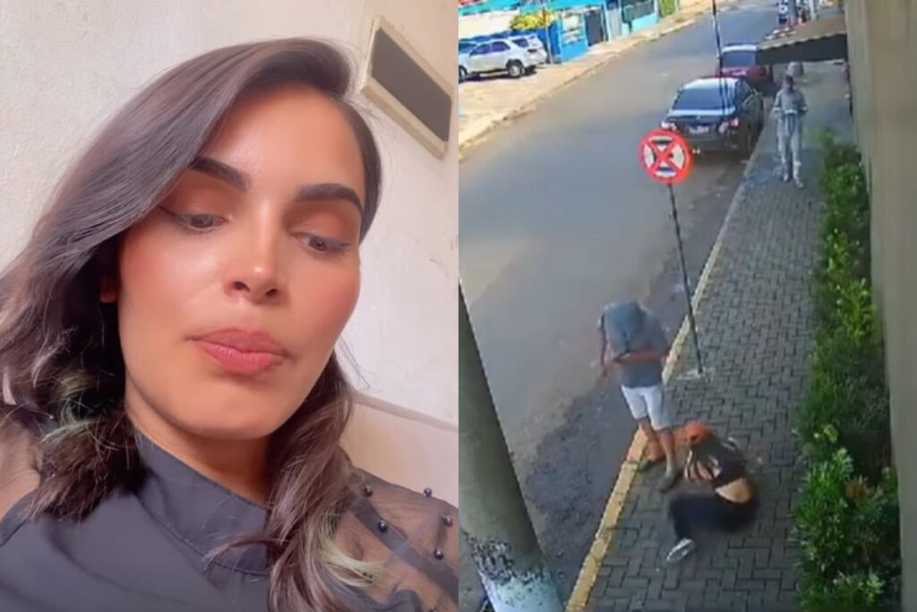 jovem-atacada-com-acido-publica-video jovem-atacada-com-acido-publica-video