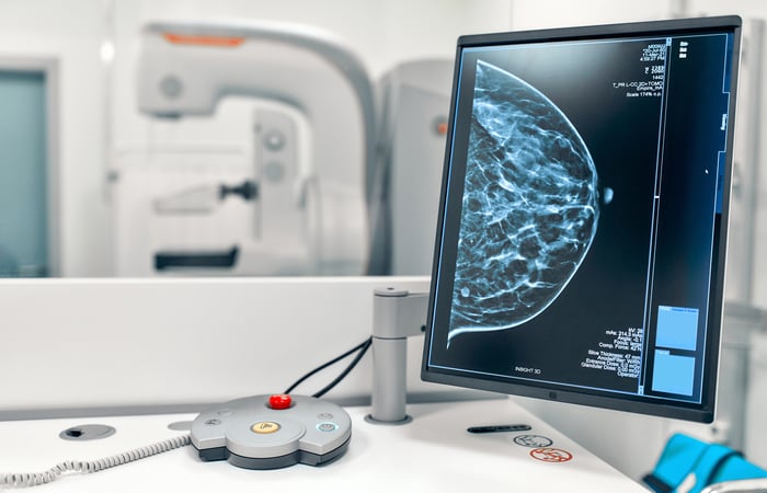 Mammogram snapshot of breasts of a female patient on the monitor Mammogram snapshot of breasts of a female patient on the monitor