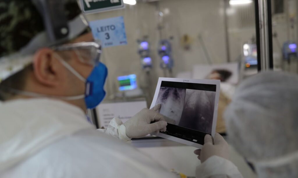 radiografia_de_torax_coronaviruscovid-19_hospital_sao_paulo1205200326