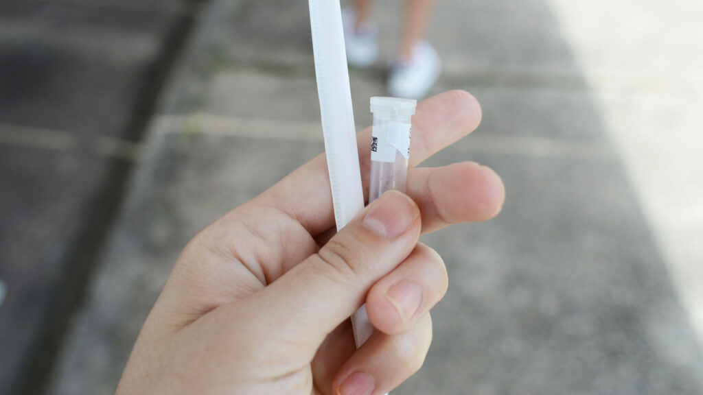 teste-covid-saliva-ufpr teste-covid-saliva-ufpr