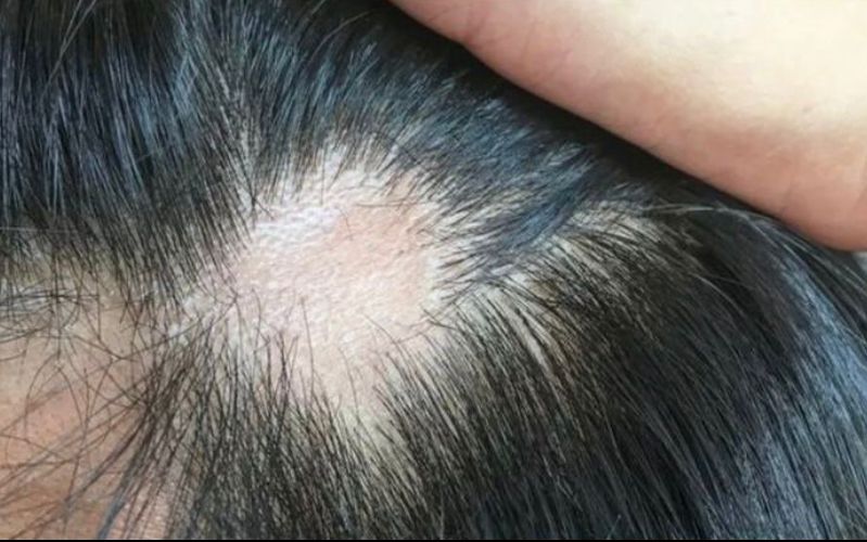 vm-cabelo-covid