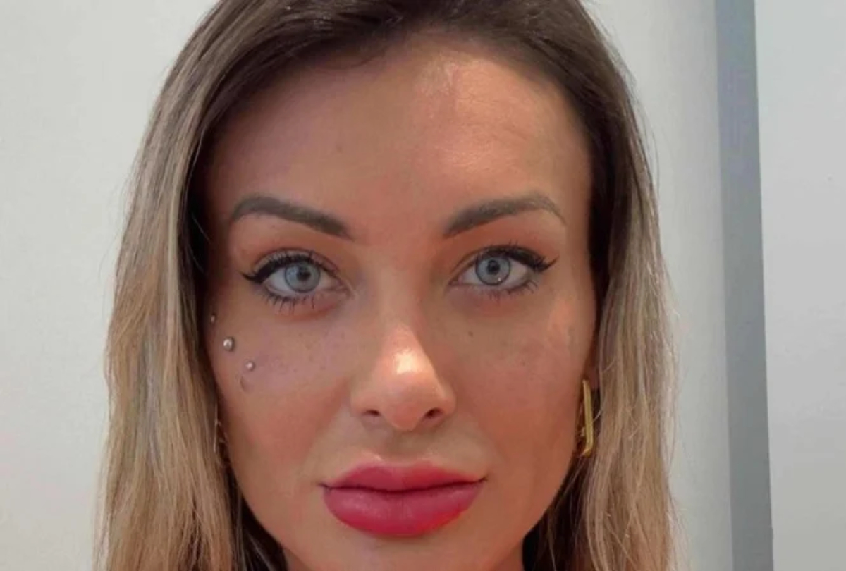 Andressa Urach relata dor intensa após mudar a cor dos olhos