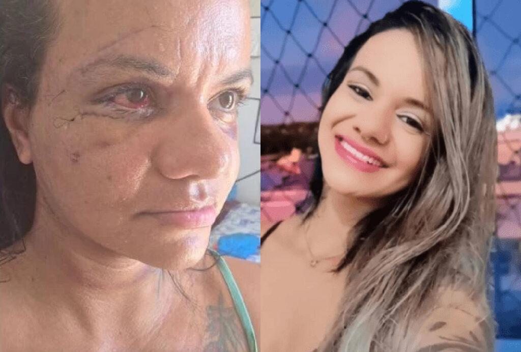 mulher-que-levou-61-socos-rosto
