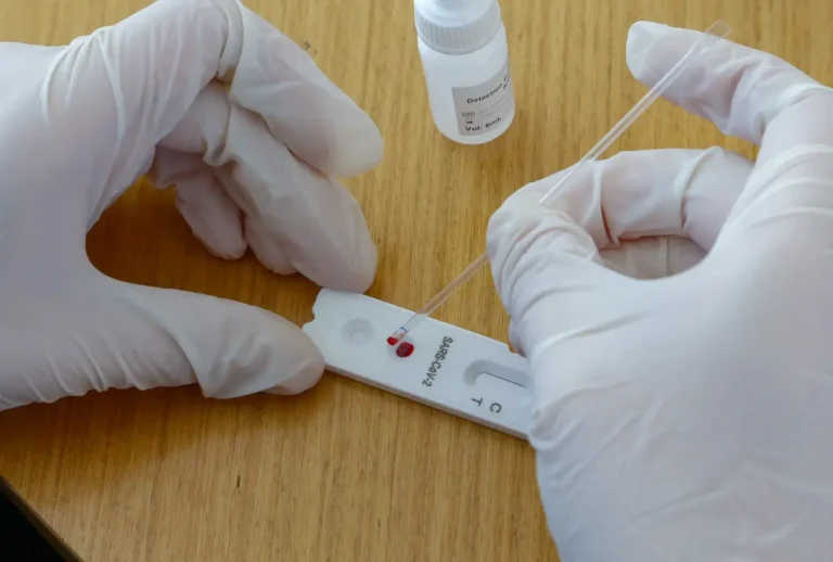 teste rápido de covid-19