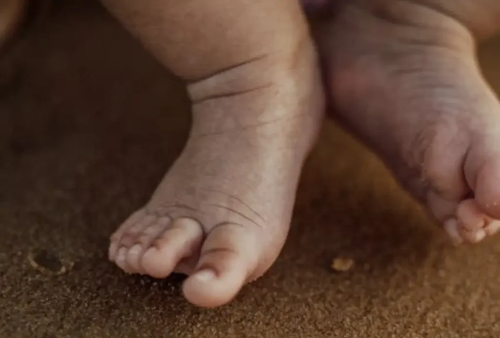 Pais foram presos suspeitos de matar o bebê; na foto, pés de bebe