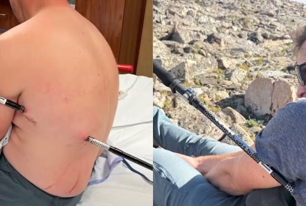 Enfermeiro sobreviveu a um grave acidente durante uma escalada