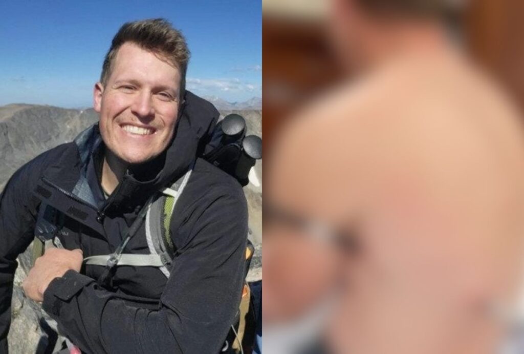 Enfermeiro sobreviveu a um grave acidente durante uma escalada