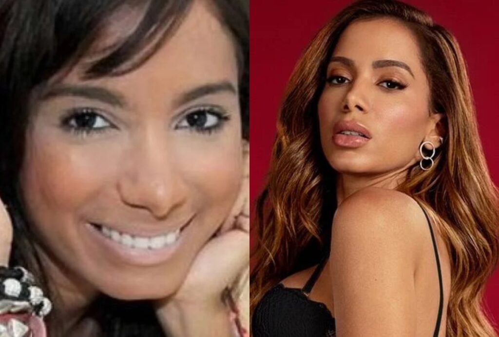 Anitta Antes e depois das cirurgias
