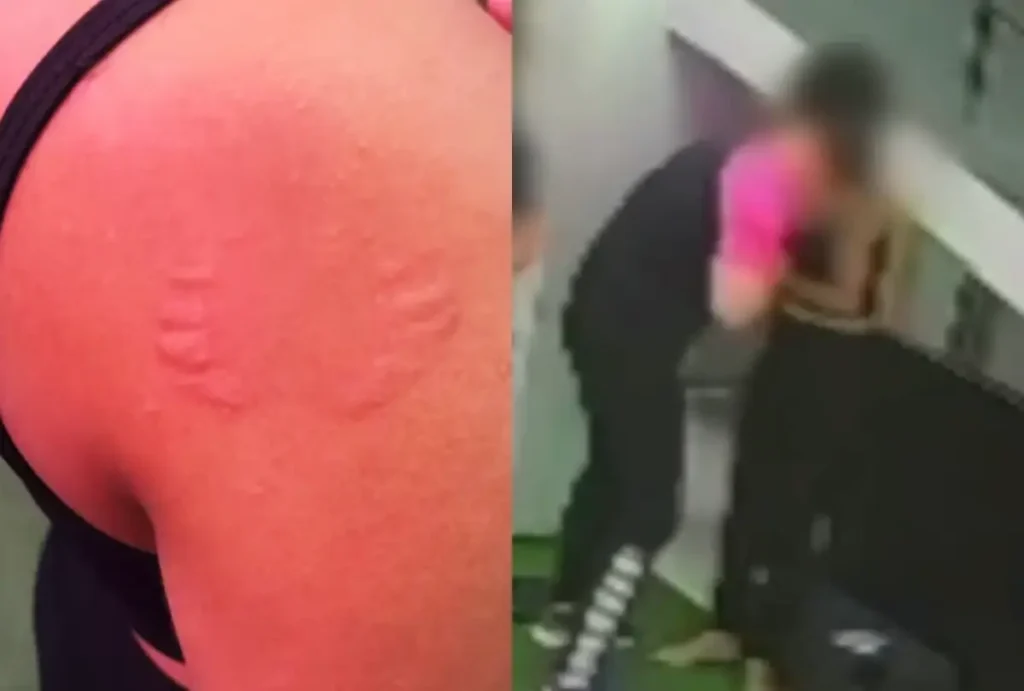 Mulher foi mordida por instrutor em academia