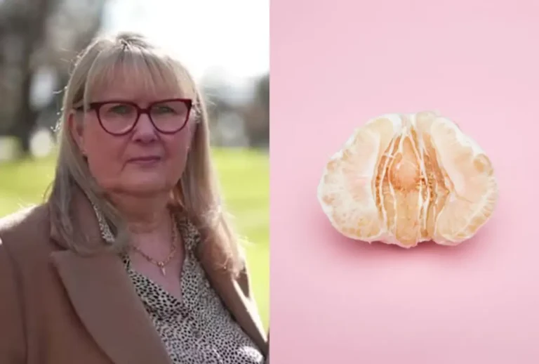 Uma mulher, identificada como Debra Buchanan, foi ao hospital retirar uma verruga e perdeu a genitália durante uma cirurgia.