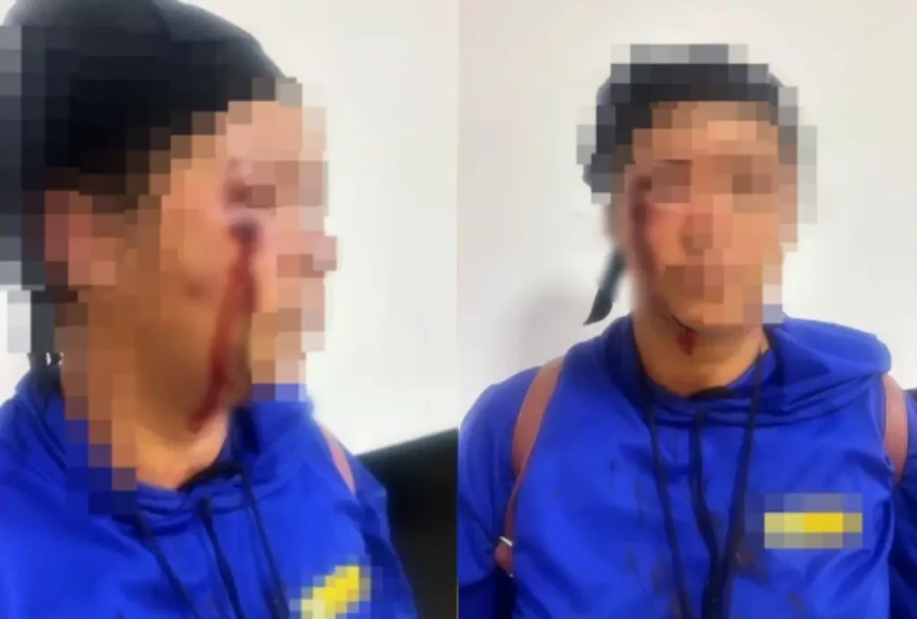 Mulher é chicoteada após acusação de traição em Goiás
